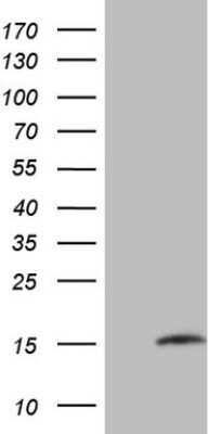 Western Blot: MGP Antibody (OTI11G6) - Azide and BSA Free [NBP2-72660] - Analysis of HEK293T cells were transfected with the pCMV6-ENTRY control (Left lane) or pCMV6-ENTRY MGP.