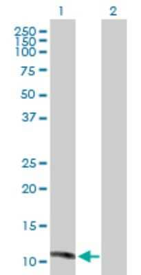 Western Blot: MGP Antibody [H00004256-D01P] - Analysis of MGP expression in transfected 293T cell line by MGP polyclonal antibody.Lane 1: MGP transfected lysate(12.30 KDa).Lane 2: Non-transfected lysate.