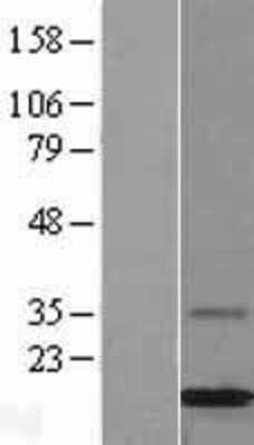 Western Blot: MGP Overexpression Lysate (Adult Normal) [NBL1-13091] Left-Empty vector transfected control cell lysate (HEK293 cell lysate); Right -Over-expression Lysate for MGP.