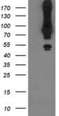 Western Blot MGRN1 Antibody (OTI3C3) - Azide and BSA Free