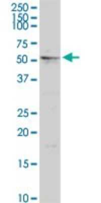 Western Blot: MGRN1 Antibody [H00023295-D01P] - Analysis of MGRN1 expression in HepG2.