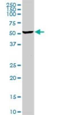 Western Blot: MGRN1 Antibody [H00023295-D01P] - Analysis of MGRN1 expression in human kidney.