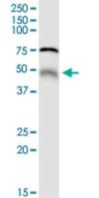 Western Blot: MGRN1 Antibody [H00023295-D01P] - Analysis of MGRN1 expression in human stomach.