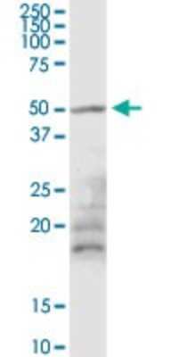 Western Blot: MGRN1 Antibody [H00023295-D01P] - Analysis of MGRN1 expression in mouse spleen.