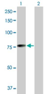 Western Blot: MGRN1 Antibody [H00023295-D01P] - Analysis of MGRN1 expression in transfected 293T cell line by MGRN1 polyclonal antibody.Lane 1: MGRN1 transfected lysate(63.20 KDa).Lane 2: Non-transfected lysate.