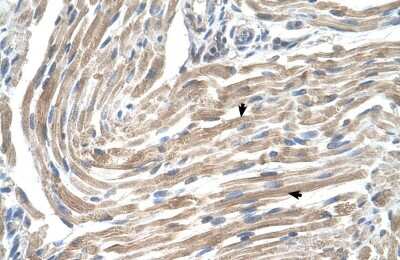 Immunohistochemistry-Paraffin: MGST2 Antibody [NBP1-59066] - Human Muscle Tissue, Skeletal muscle cells (Indicated with Arrows) 4-8ug/ml.