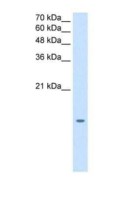 Western Blot MGST2 Antibody