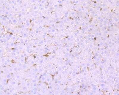 Immunohistochemistry-Paraffin: MGST3 Antibody (JB40-79) [NBP2-75573] - Analysis of paraffin-embedded human liver tissue using anti-GST3 antibody. Counter stained with hematoxylin.