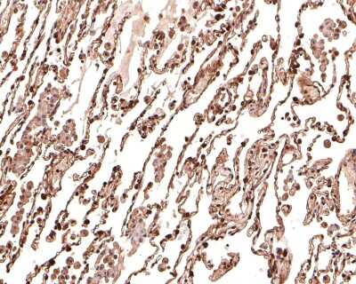 Immunohistochemistry-Paraffin: MGST3 Antibody (JB40-79) [NBP2-75573] - Analysis of paraffin-embedded human lung tissue with Rabbit anti-MGST3 antibody washed with ddH2O and PBS, and then probed with the primary antibody  at 1/500 dilution for 1 hour at room temperature. The detection was performed using an HRP conjugated compact polymer system. DAB was used as the chromogen. Tissues were counterstained with hematoxylin and mounted with DPX.