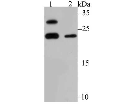 Western Blot: MGST3 Antibody (JB40-79) [NBP2-75573] - Analysis of GST3 on mouse liver tissue (1) and A549 cell (2) lysate using anti-GST3 antibody at 1/500 dilution.