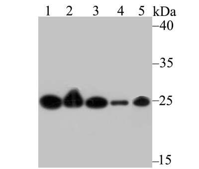 Western Blot: MGST3 Antibody [NBP2-75572] - Analysis of GST3 on different cell lysate using anti-GST3 antibody at 1/1,000 dilution.Positive control:Lane1: Siha      Lane2: HelaLane3: A549      Lane4: Mouse kidney tissueLane5: Rat liver tissue