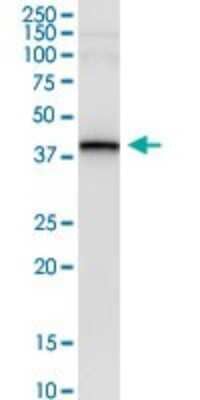Western Blot: MHC Class I Antibody [H00003133-D01P] - Analysis of HLA-E transfected lysate using anti-HLA-E rabbit polyclonal antibody and Protein Magnetic Bead, and immunoblotted with HLA-E purified mouse polyclonal antibody (B01P).
