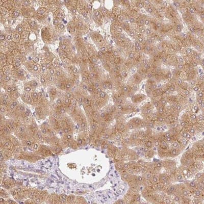 Immunohistochemistry-Paraffin: MIA2 Antibody [NBP2-33704] - Staining of human liver shows moderate cytoplasmic positivity in hepatocytes.
