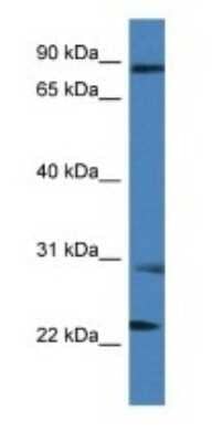 Western Blot: MIA2 Antibody [NBP1-74078] - Titration: 1.0 ug/ml Positive Control: THP-1 Whole Cell.