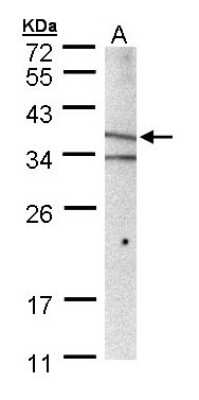 Western Blot: MICA Antibody [NBP1-32830] - Sample (30 ug of whole cell lysate) A: A431 10% SDS PAGE; antibody diluted at 1:1000.