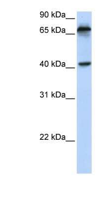 Western Blot: MICA Antibody [NBP1-59184] - Titration: 0.2-1 ug/ml, Positive Control: Hela cell lysate.