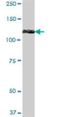 Western Blot: MICAL1 Antibody [H00064780-B01P] - MICAL1 MaxPab polyclonal antibody. Western Blot analysis of MICAL1 expression in human spleen.