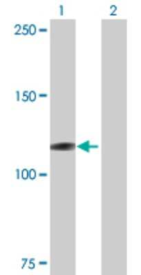 Western Blot: MICAL1 Antibody [H00064780-B01P] - Analysis of MICAL1 expression in transfected 293T cell line by MICAL1 polyclonal antibody.  Lane 1: MICAL1 transfected lysate(107.91 KDa). Lane 2: Non-transfected lysate.