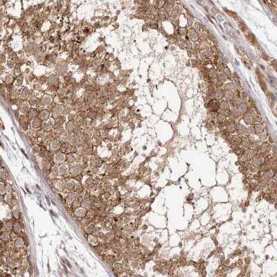 Immunohistochemistry-Paraffin MICAL2 Antibody - BSA Free