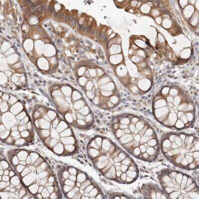 Immunohistochemistry-Paraffin: MICAL2 Antibody [NBP1-81483] - Staining of human colon shows moderate cytoplasmic/membranous positivity in glandular cells.