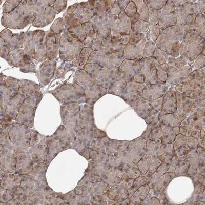 Immunohistochemistry-Paraffin MICAL2 Antibody - BSA Free