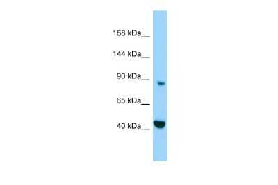 Western Blot: MICAL2 Antibody [NBP2-83205] - Host: Rabbit. Target Name: MICAL2. Sample Type: HepG2 Whole Cell lysates. Antibody Dilution: 1.0ug/ml