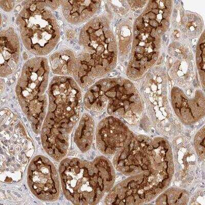 Immunohistochemistry: MICALL2 Antibody [NBP1-82073] - Staining of human kidney shows strong cytoplasmic and membrane positivity in cells in tubules.