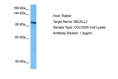 Western Blot: MICALL2 Antibody [NBP2-83208] - Host: Rabbit. Target Name: MICALL2. Sample Tissue: Human COLO205 Whole Cell lysates. Antibody Dilution: 1ug/ml