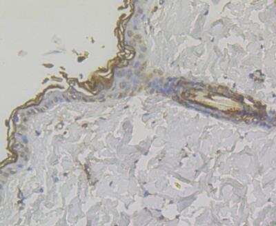Immunohistochemistry: MICB Antibody [NBP2-76950] - Immunohistochemical analysis of paraffin-embedded rat skin tissue using anti-MICA + MICB antibody. The section was pre-treated using heat mediated antigen retrieval with Tris-EDTA buffer (pH 8.0-8.4) for 20 minutes.The tissues were blocked in 5% BSA for 30 minutes at room temperature, washed with ddH2O and PBS, and then probed with the antibody at 1/50 dilution, for 30 minutes at room temperature and detected using an HRP conjugated compact polymer system. DAB was used as the chrogen. Counter stained with hematoxylin and mounted with DPX.
