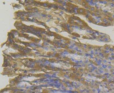 Immunohistochemistry: MICB Antibody [NBP2-76950] - Immunohistochemical analysis of paraffin-embedded mouse stomach tissue using anti-MICA + MICB antibody. The section was pre-treated using heat mediated antigen retrieval with Tris-EDTA buffer (pH 8.0-8.4) for 20 minutes.The tissues were blocked in 5% BSA for 30 minutes at room temperature, washed with ddH2O and PBS, and then probed with the antibody at 1/200 dilution, for 30 minutes at room temperature and detected using an HRP conjugated compact polymer system. DAB was used as the chrogen. Counter stained with hematoxylin and mounted with DPX.