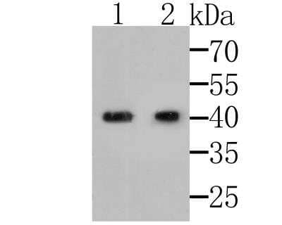 Western Blot: MICB Antibody [NBP2-76950] - Western blot analysis of MICA + MICB on different lysates. Proteins were transferred to a PVDF membrane and blocked with 5% BSA in PBS for 1 hour at room temperature. The primary antibody was used at a 1:500 dilution in 5% BSA at room temperature for 2 hours. Goat Anti-Rabbit IgG - HRP Secondary Antibody at 1:5,000 dilution was used for 1 hour at room temperature.Positive control:Lane 1: U937Lane 2: Mouse bone marrow