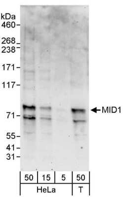 Western Blot: MID1 Antibody [NBP1-26612] - Whole cell lysate from HeLa (5, 15 and 50 ug) and 293T (T; 50 ug) cells. Antibody used at 1 ug/ml.