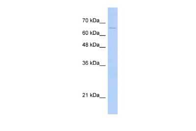 Western Blot: MID1 Antibody [NBP2-86695] - Host: Rabbit. Target Name: MID1. Sample Type: Transfected 293T Whole Cell lysates. Antibody Dilution: 1.0ug/ml