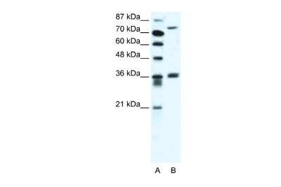 Western Blot: MID1 Antibody [NBP2-86706] - WB Suggested Anti-MID1 Antibody Titration: 2.5ug/ml. ELISA Titer: 1:312500. Positive Control: Jurkat cell lysate