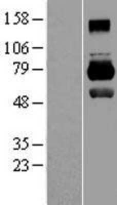 Western Blot: MID1 Overexpression Lysate (Adult Normal) [NBL1-13103] Left-Empty vector transfected control cell lysate (HEK293 cell lysate); Right -Over-expression Lysate for MID1.