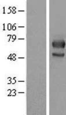 Western Blot: MID1 Overexpression Lysate (Adult Normal) [NBP2-08319] Left-Empty vector transfected control cell lysate (HEK293 cell lysate); Right -Over-expression Lysate for MID1.