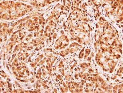 Immunohistochemistry-Paraffin: MID1IP1 Antibody [NBP1-32599] - Paraffin-embedded A549 xenograft, using antibody at 1:100 dilution.