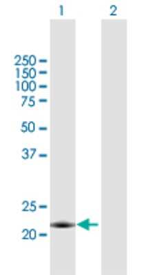 Western Blot: MID1IP1 Antibody [H00058526-B01P] - Analysis of MID1IP1 expression in transfected 293T cell line by MID1IP1 polyclonal antibody.  Lane 1: MID1IP1 transfected lysate(20.13 KDa). Lane 2: Non-transfected lysate.