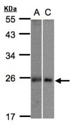 Western Blot: MID1IP1 Antibody [NBP1-32599] - Sample(30 ug whole cell lysate)A:293TB:Hep G2  12% SDS PAGE, antibody diluted at 1:1000.