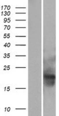 Western Blot: MID1IP1 Overexpression Lysate (Adult Normal) [NBP2-08330] Left-Empty vector transfected control cell lysate (HEK293 cell lysate); Right -Over-expression Lysate for MID1IP1.