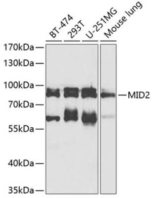 Western Blot: MID2 Antibody [NBP3-05060] - Analysis of extracts of various cell lines, using MID2 antibody at 1:1000 dilution. Secondary antibody: HRP Goat Anti-Rabbit IgG (H+L) at 1:10000 dilution. Lysates/proteins: 25ug per lane. Blocking buffer: 3% nonfat dry milk in TBST. Detection: ECL Basic Kit