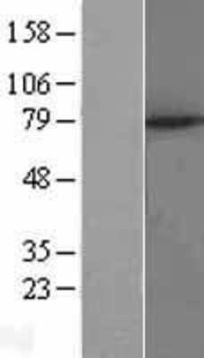 Western Blot: MID2 Overexpression Lysate (Adult Normal) [NBL1-13105] Left-Empty vector transfected control cell lysate (HEK293 cell lysate); Right -Over-expression Lysate for MID2.