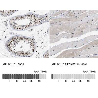 Immunohistochemistry-Paraffin: MIER1 Antibody [NBP1-81730] - Staining in human testis and skeletal muscle tissues using anti-MIER1 antibody. Corresponding MIER1 RNA-seq data are presented for the same tissues.
