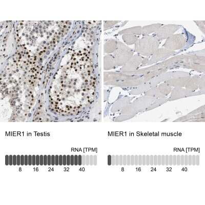 Immunohistochemistry-Paraffin: MIER1 Antibody [NBP1-81730] - Analysis in human testis and skeletal muscle tissues. Corresponding MIER1 RNA-seq data are presented for the same tissues.