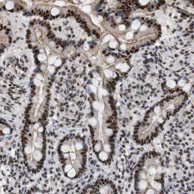 Immunohistochemistry-Paraffin: MIER1 Antibody [NBP1-81730] - Staining of human duodenum shows strong nuclear positivity in glandular cells.