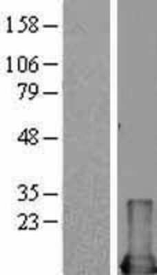 Western Blot: MIF Overexpression Lysate (Adult Normal) [NBL1-13108] Left-Empty vector transfected control cell lysate (HEK293 cell lysate); Right -Over-expression Lysate for MIF.