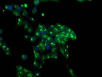 Immunocytochemistry/Immunofluorescence: MIF4GD Antibody (4C11) [NBP2-01876] - Immunofluorescent staining of HeLa cells using anti-MIF4GD mouse monoclonal antibody.