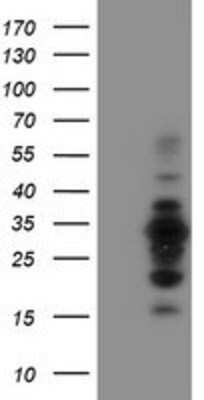 Western Blot MIF4GD Antibody (OTI4C11)