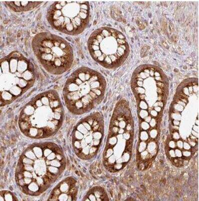 Immunohistochemistry-Paraffin: MIF4GD Antibody [NBP2-30627] - Staining of human rectum shows strong cytoplasmic positivity in glandular cells.