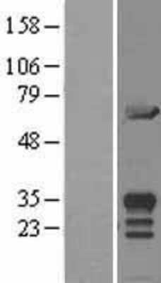 Western Blot: MIF4GD Overexpression Lysate (Adult Normal) [NBL1-13109] Left-Empty vector transfected control cell lysate (HEK293 cell lysate); Right -Over-expression Lysate for MIF4GD.
